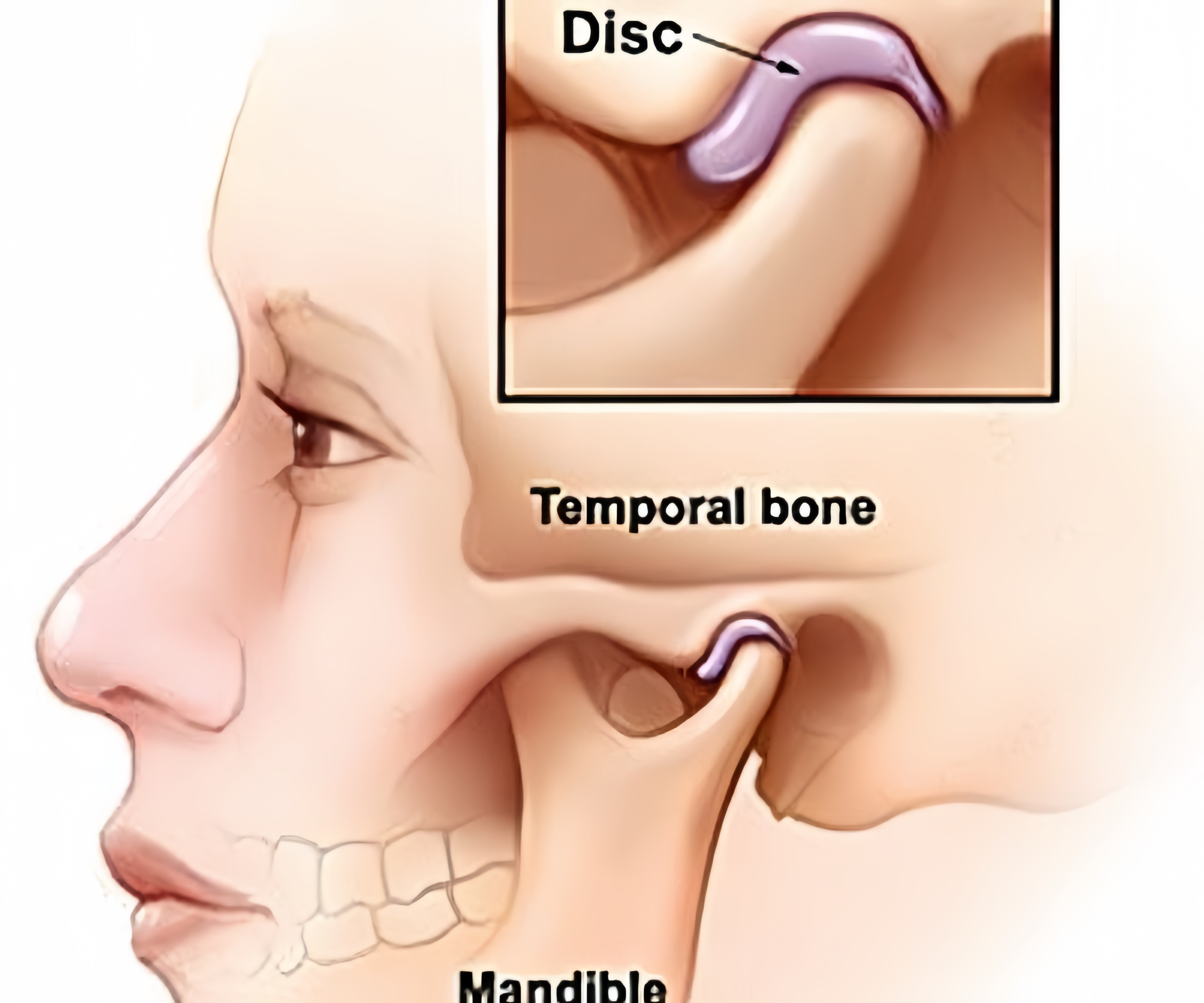 Can A Sinus Infection Cause Ear Pain