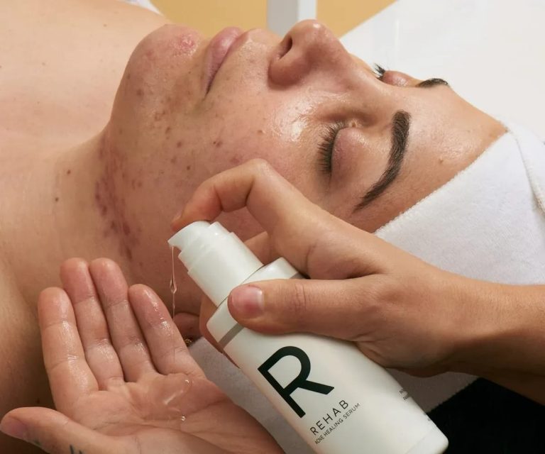 Acne healing