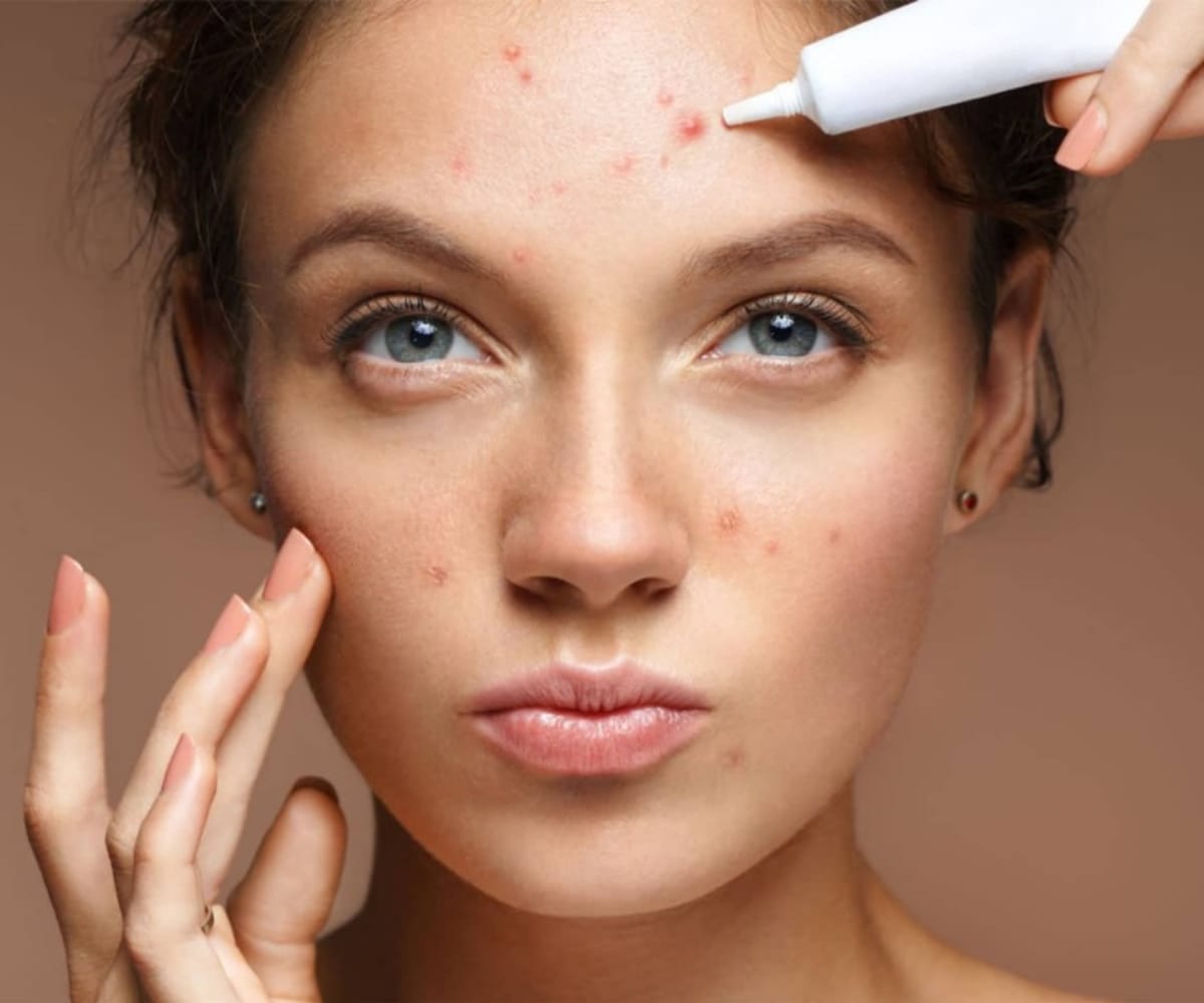 Acne Treatment