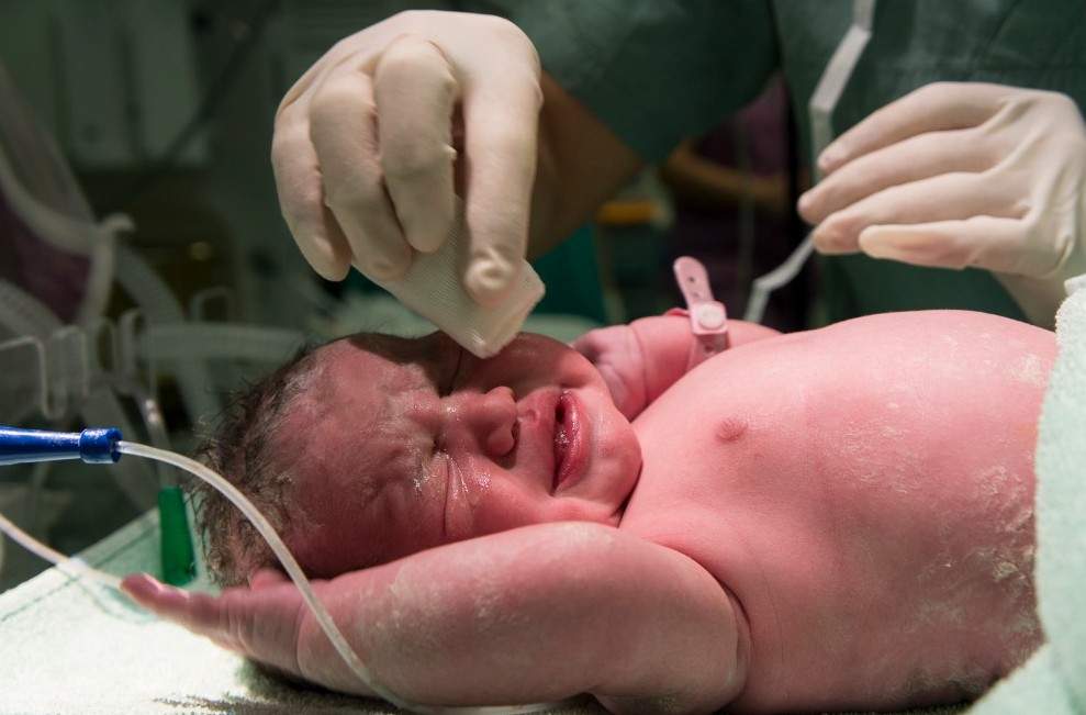 Birth-Defects
