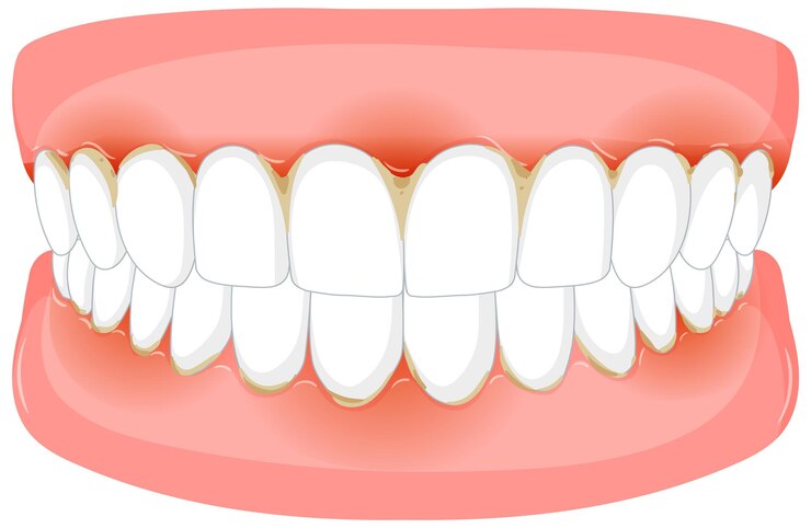 permanent teeth