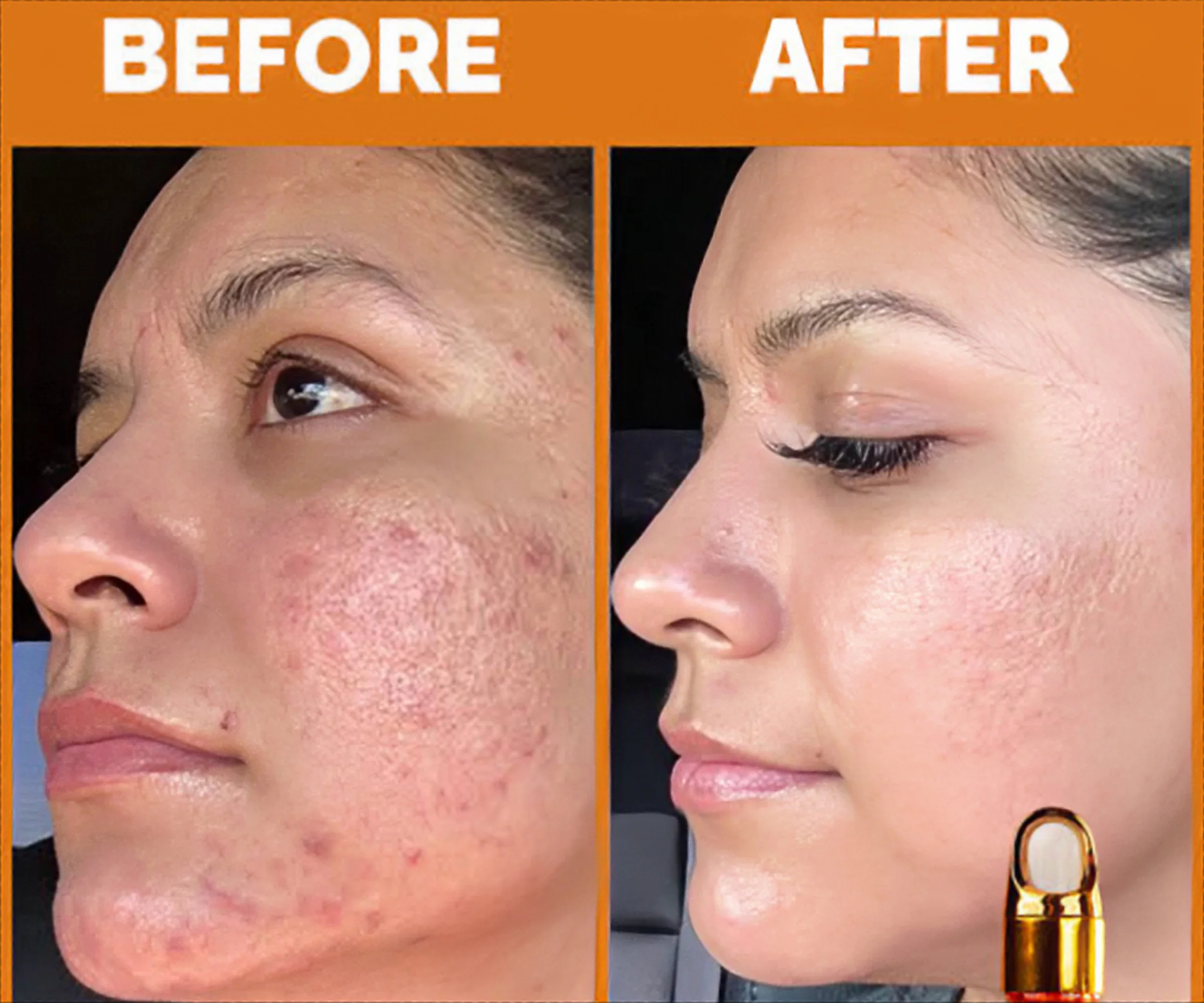 vitamin c serum before and after